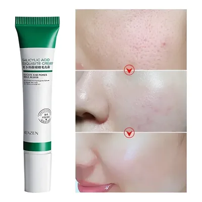 Creme De Ácido Salicílico Para Redução De Poros 20ml Todo Tipo De Pele Noite