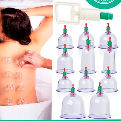 Kit Ventosas Com Bomba Ventosa Terapia Massoterapia Massagem